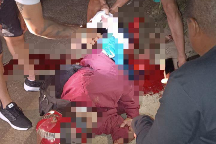 Motociclista tem perna arrancada em acidente na estrada Muriaé/Vermelho